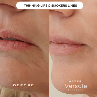 Versule Age Defying Lift & Firm Cream